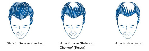 REGAINE Vyriškas tirpalas, 60 ml