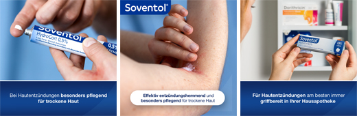 SOVENTOL Hydrocort 0,5 % kremas, 30 g