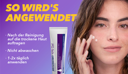 BENZAKNEN 10 % gelis, 60 g