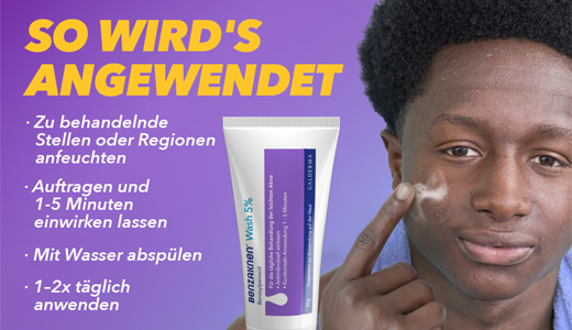 BENZAKNEN Skalbimo 5 % suspensija, 2X100 g