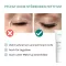 BENEVI Neutralus vokų kremas, 15 ml